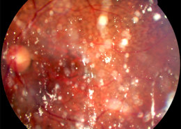 How would you diagnose this based on the image?