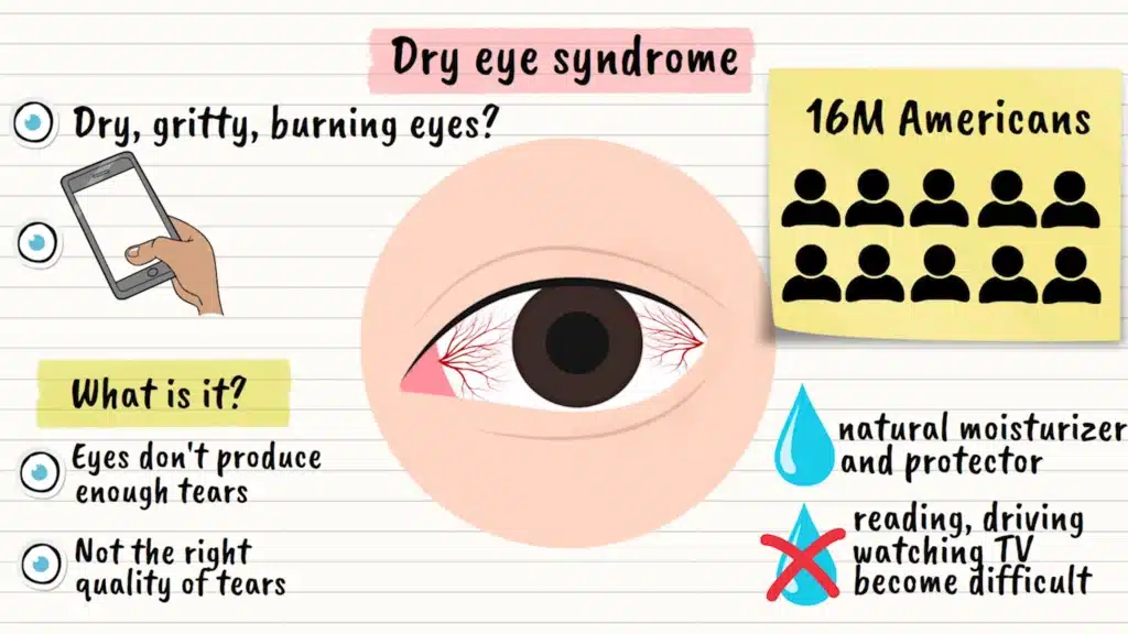 intro to dry eye syndrome