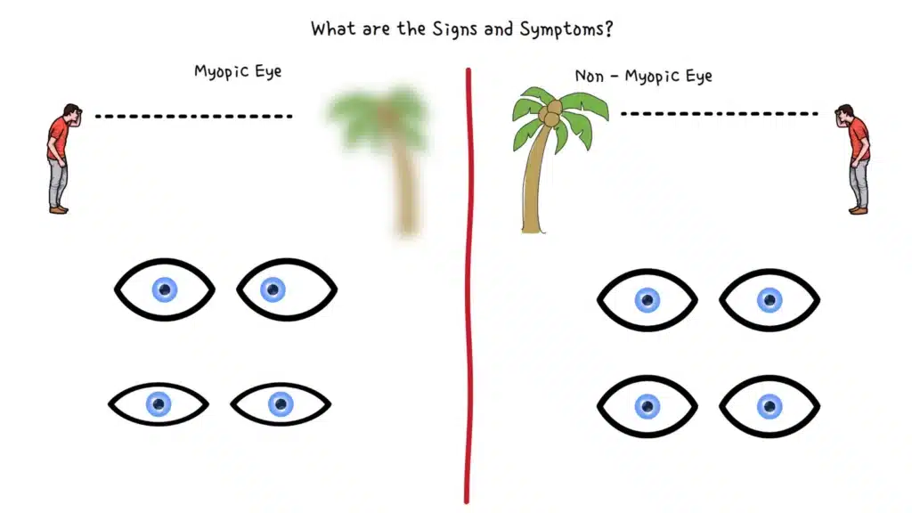 myopia signs and symptoms