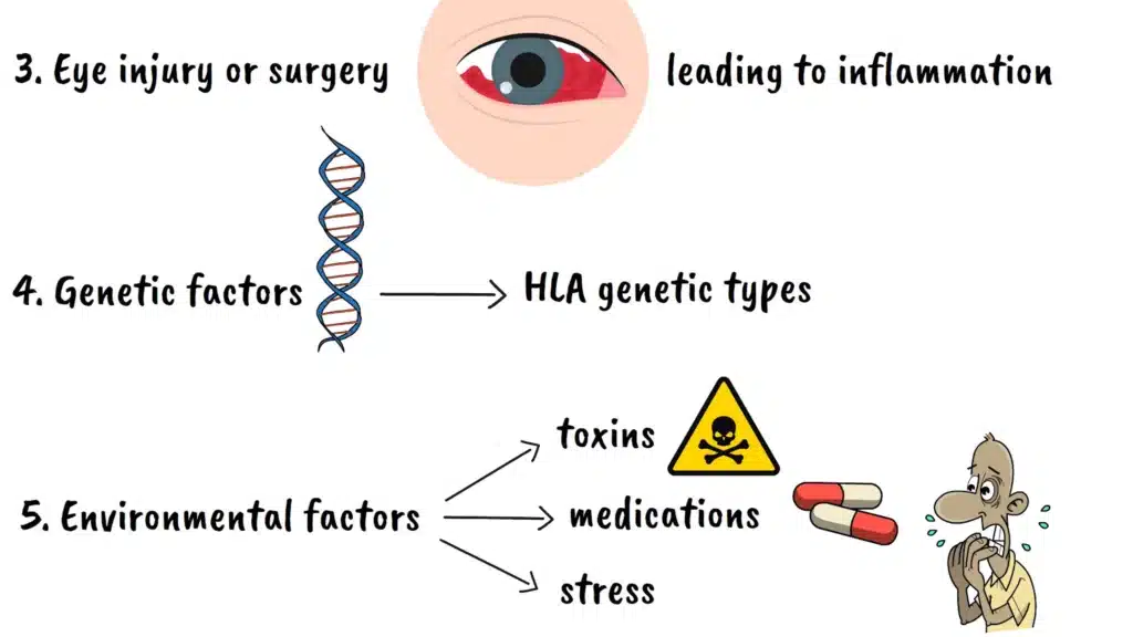 Causes of uveitis