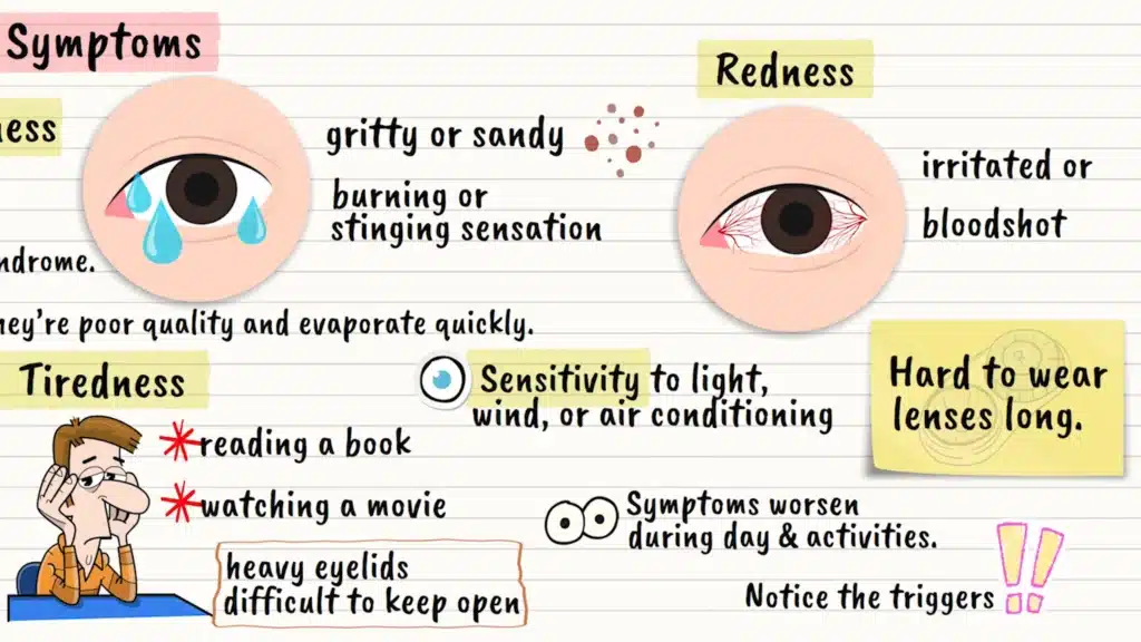 Dry eye syndrome symptoms