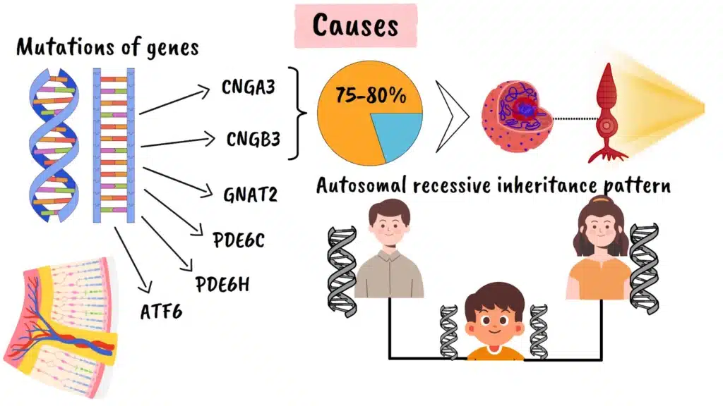 Achromatopsia causes