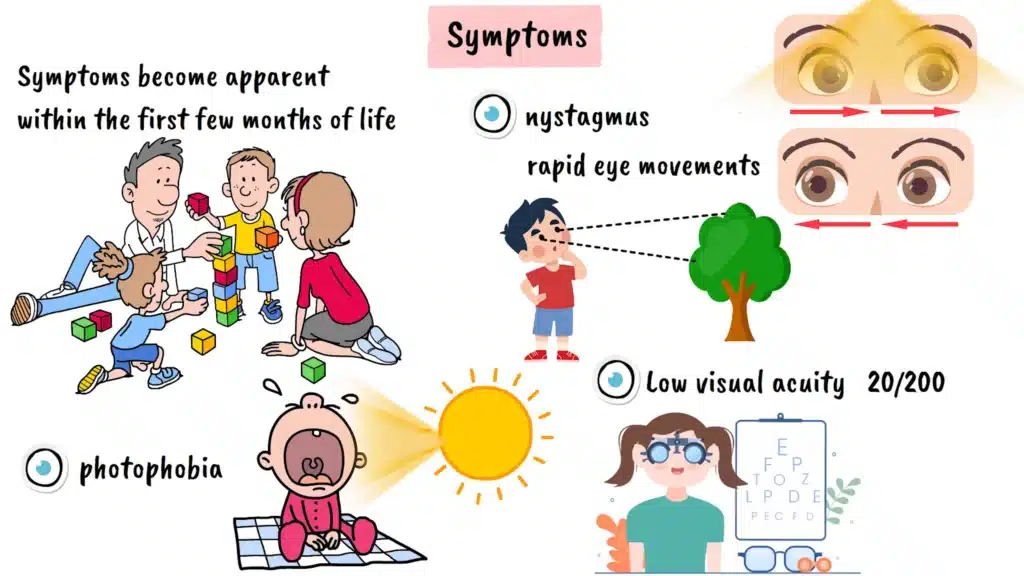 Achromatopsia symptoms