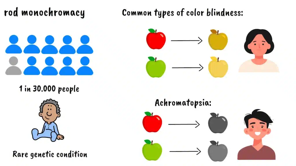Achromatopsia vs color blindness