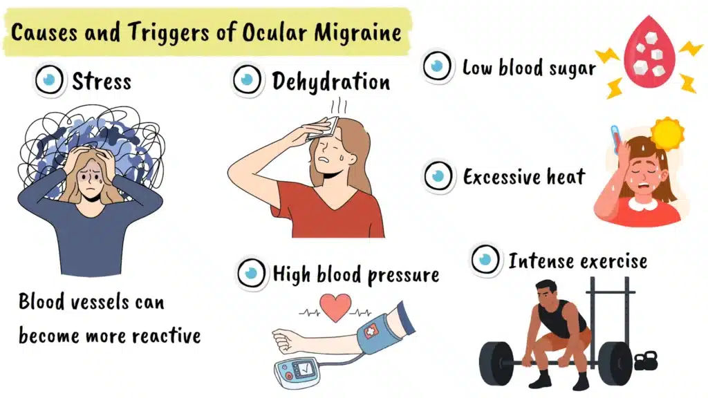 Causes of Ocular Migraine