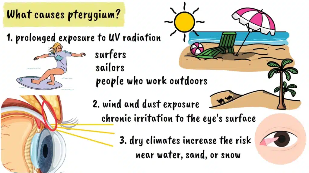 Causes of Pterygium