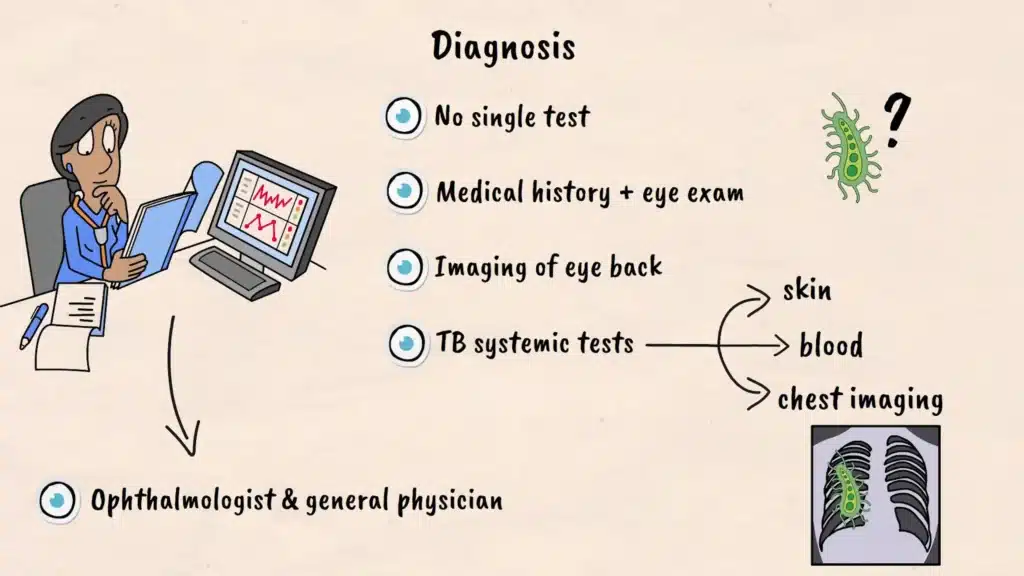 Diagnosis of Tuberculosis