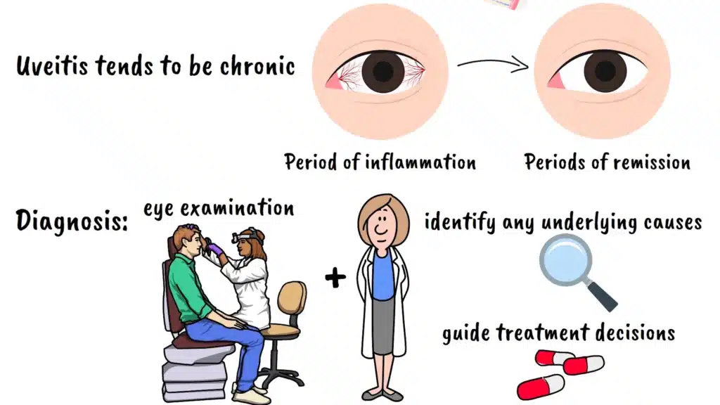 Diagnosis of uveitis