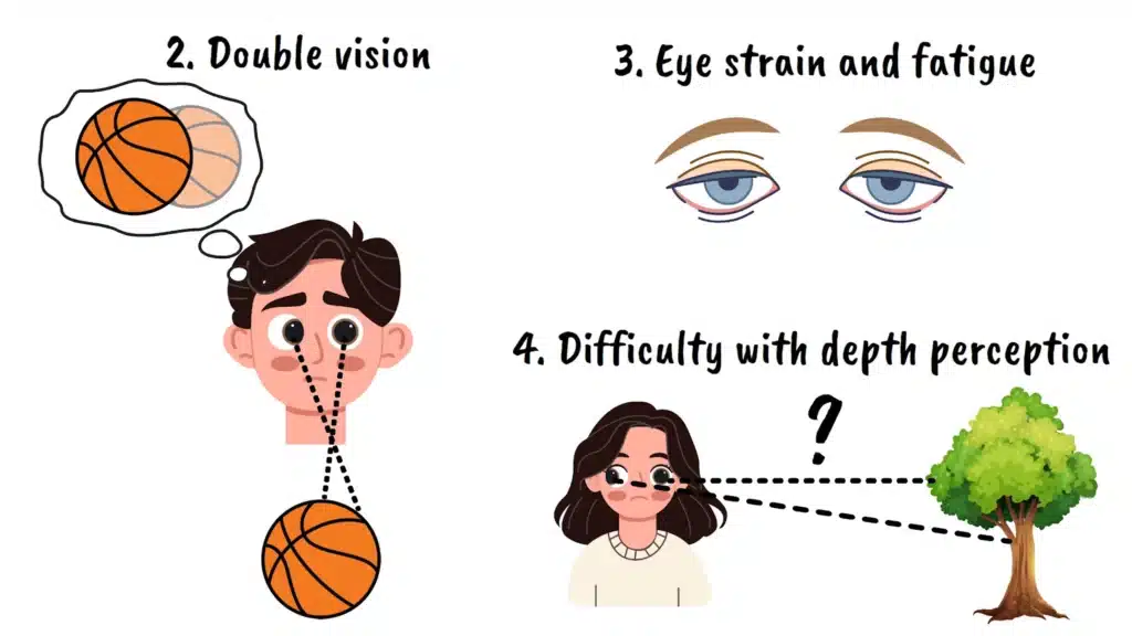 Double visions strabismus
