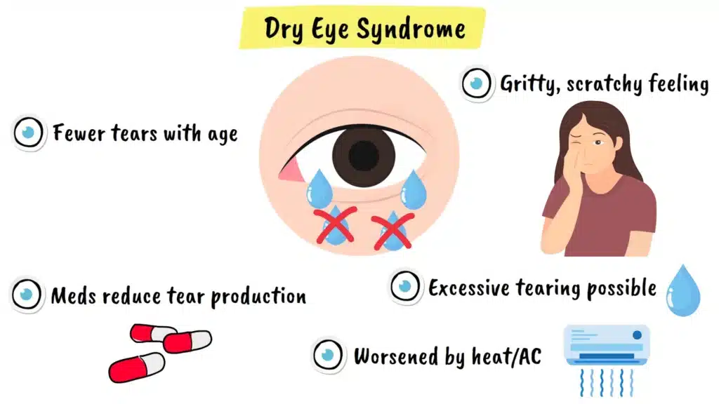Dry eye syndrome