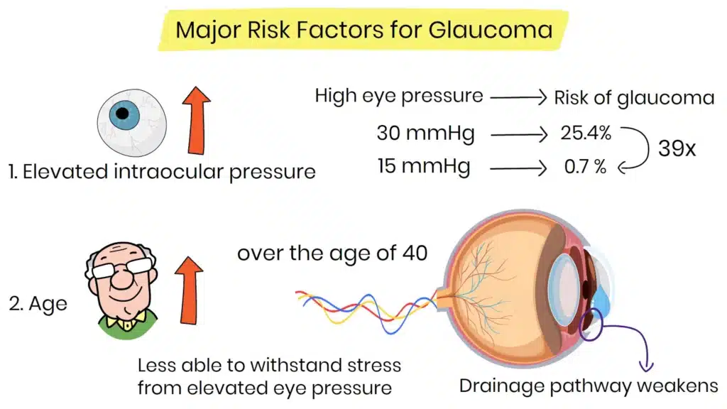 Elevator intraocular pressure and age Glaucoma Risk Factors