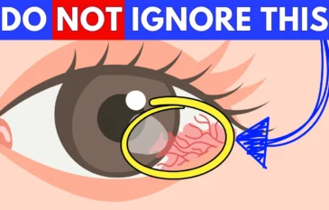 Top 5 Eye Symptoms You Should Never Ignore