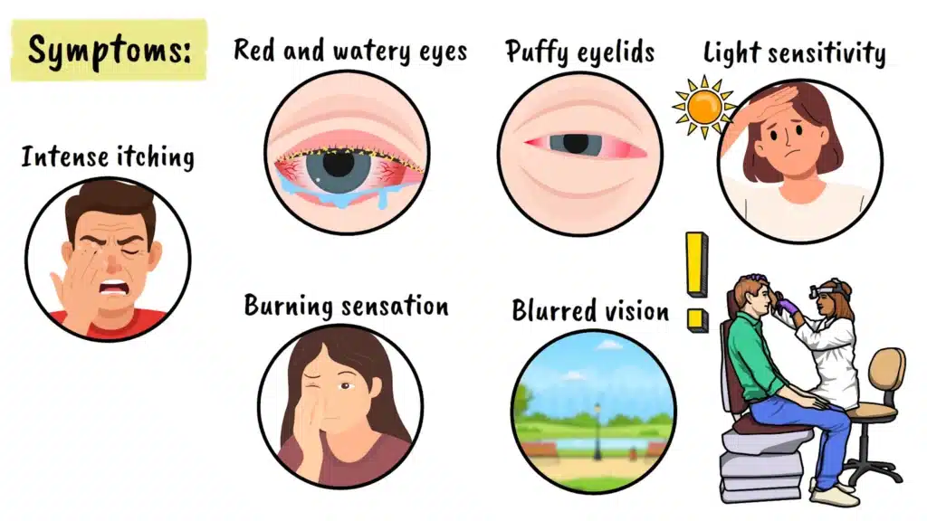 Eye allergies symptoms