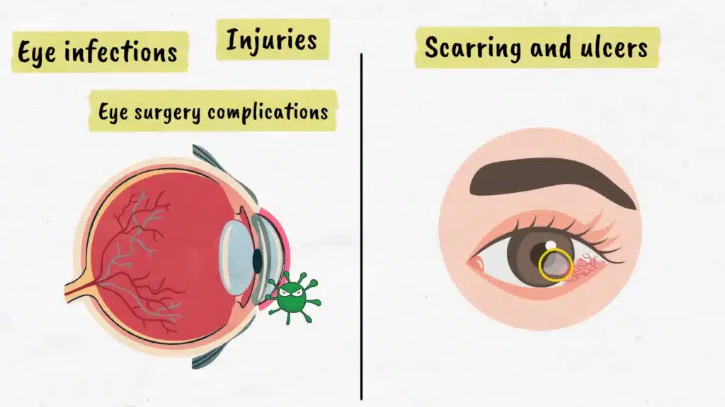 Eye infections, injuries, scarring and ulcers