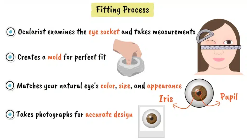 Fitting process of Ocular Prosthesis