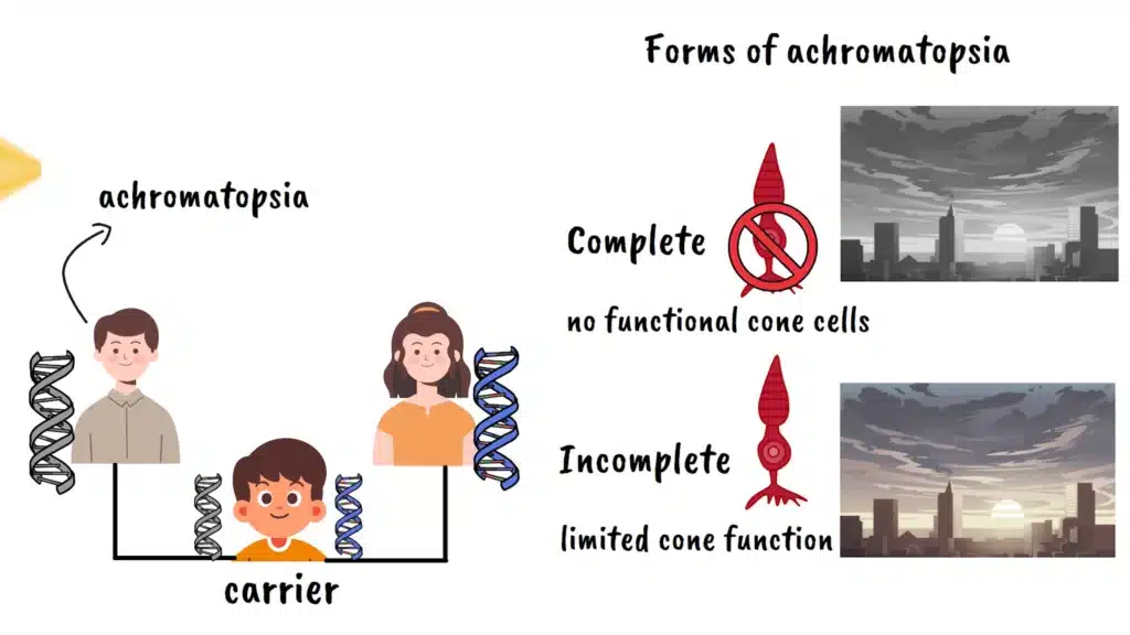 Forms of Achromatopsia