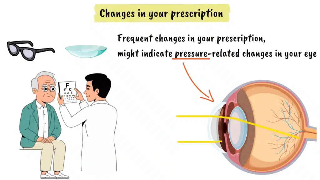 Glaucoma changes in your prescription