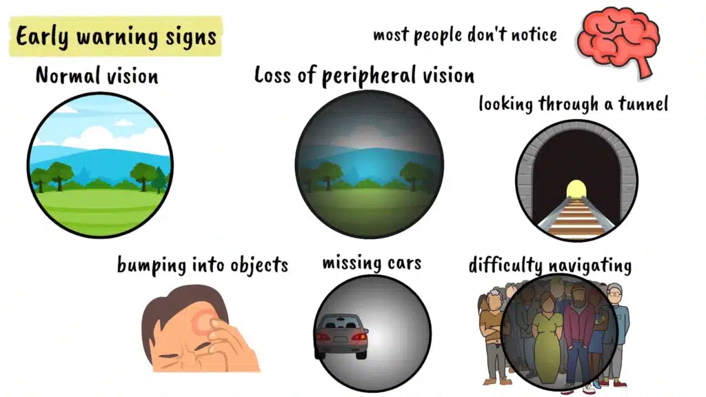 Glaucoma early warning signs