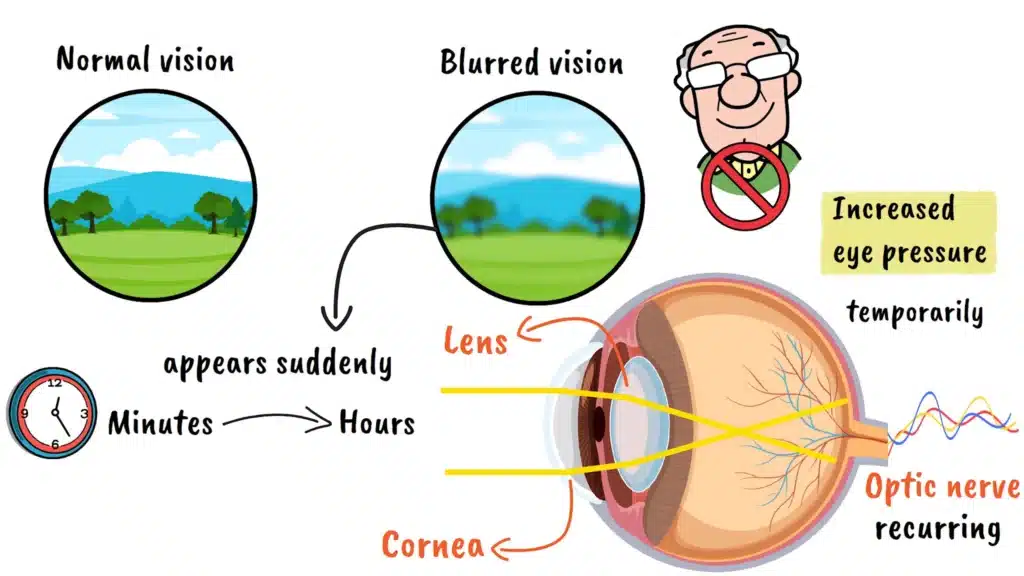 Glaucoma increased eye pressure