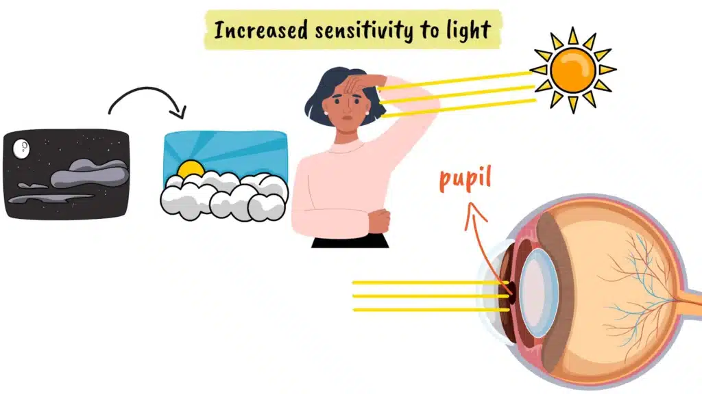 Glaucoma increased sensitivity to light