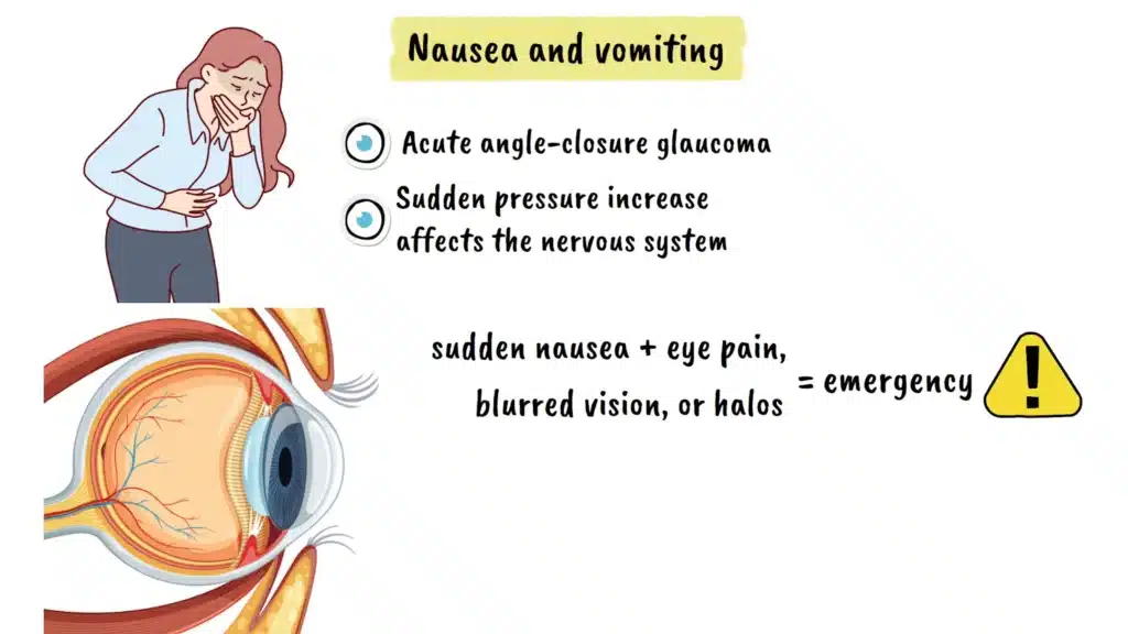 Glaucoma nausea and vomiting