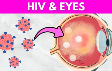 HIV & Eyes: Effects, Symptoms & Treatment