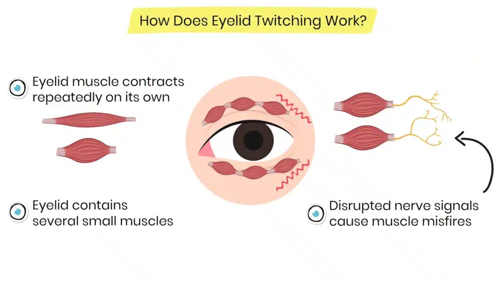 How does Eyelid Twitching work