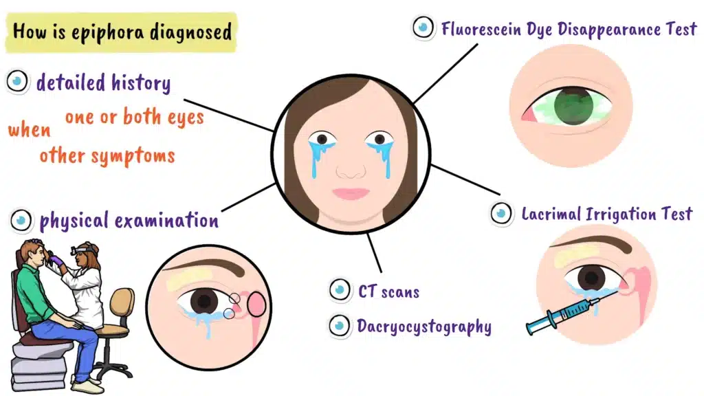 How is epiphora diagnosed