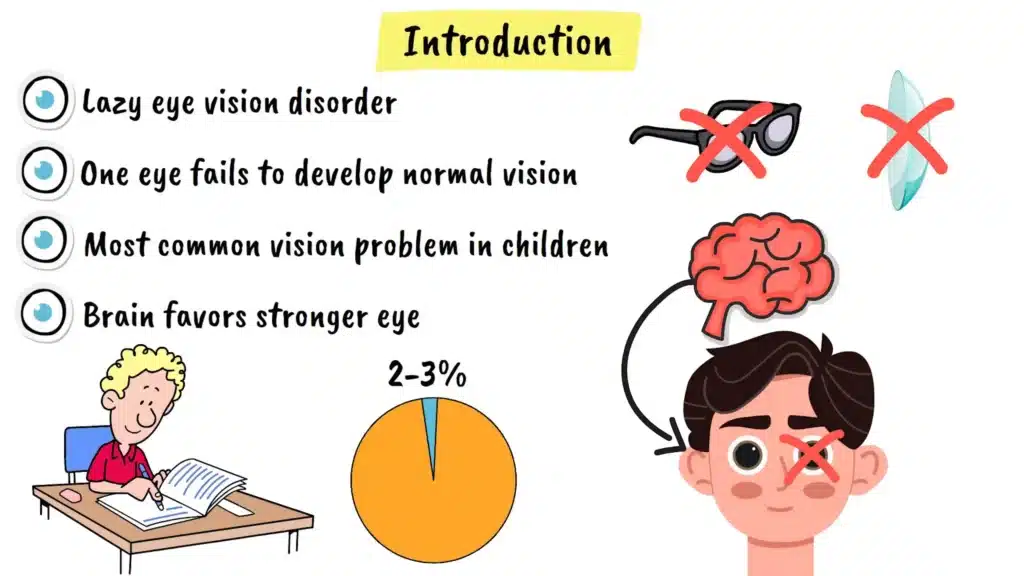 Intro to Amblyopia