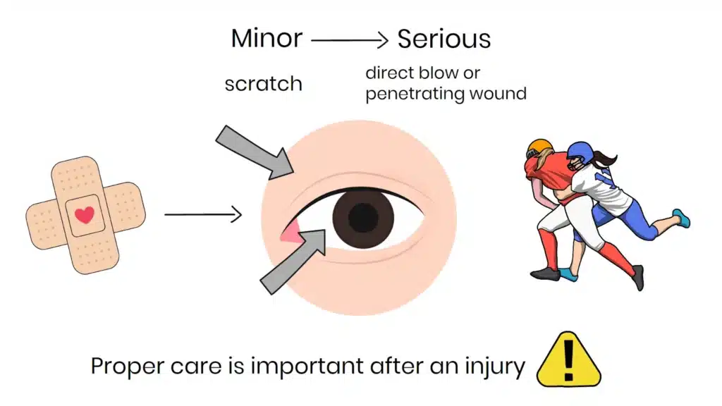 Intro to Eye Trauma