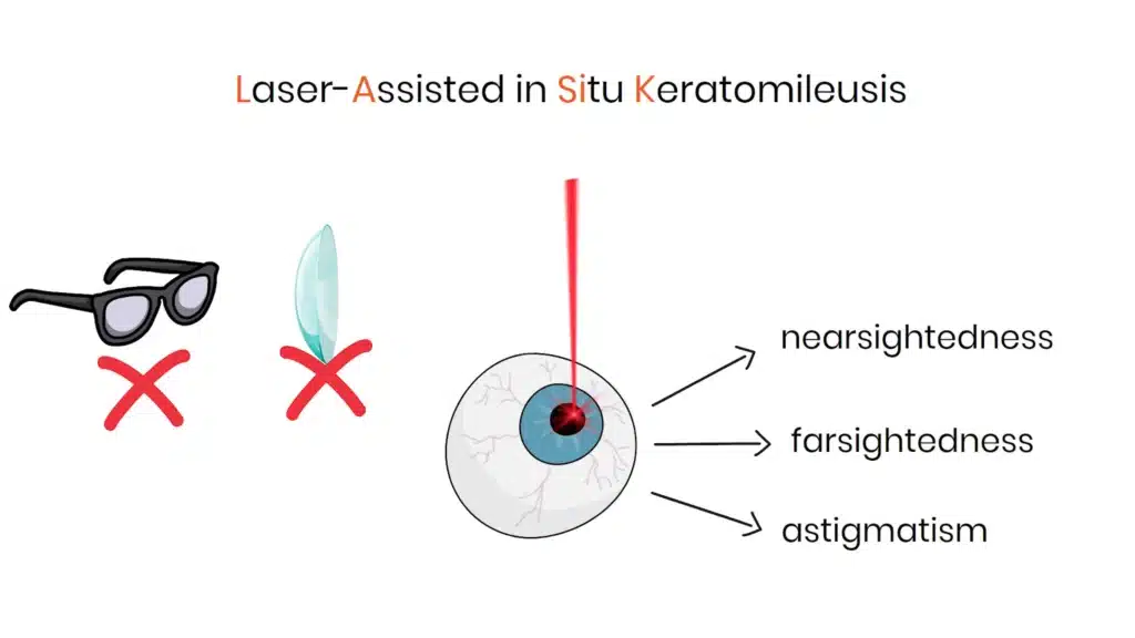 Intro to LASIK surgery
