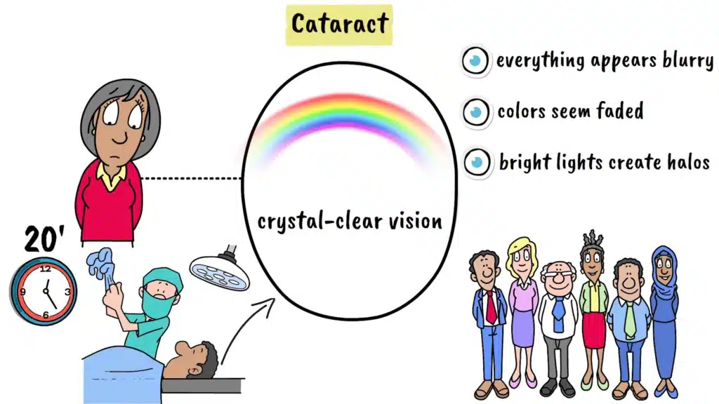 Intro to cataract surgery