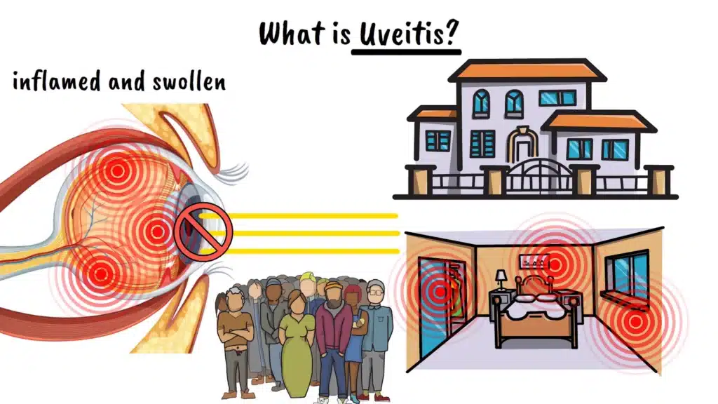 Intro uveitis
