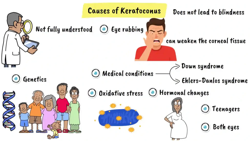 Keratoconus Causes