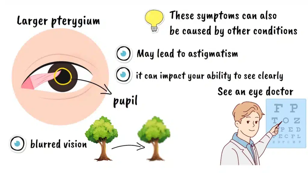 More symptoms of Pterygium