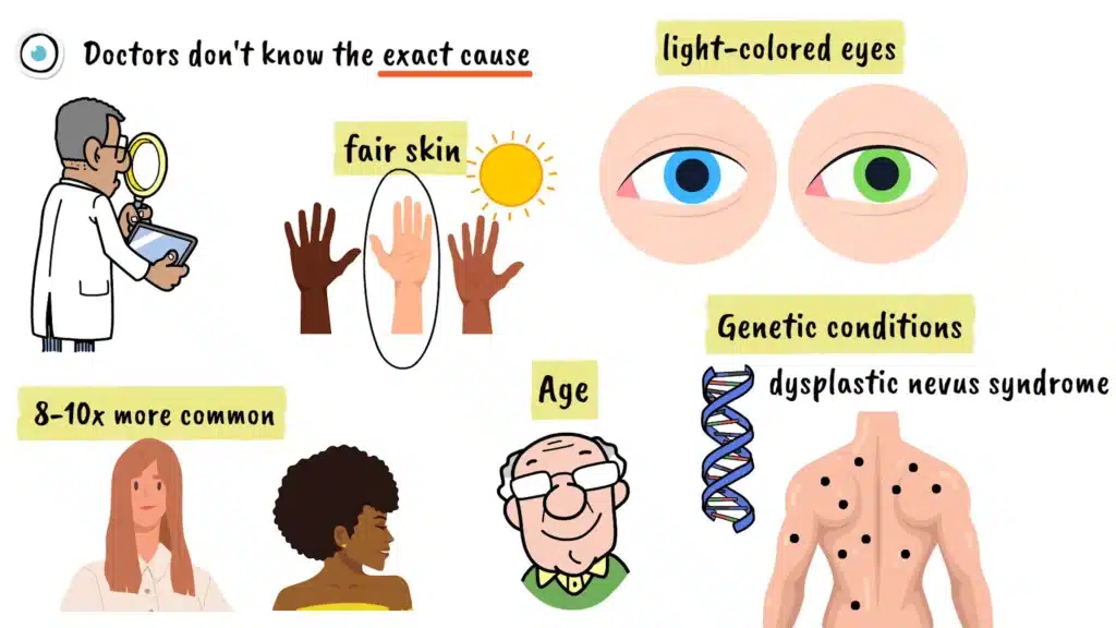 Ocular Melanoma causes