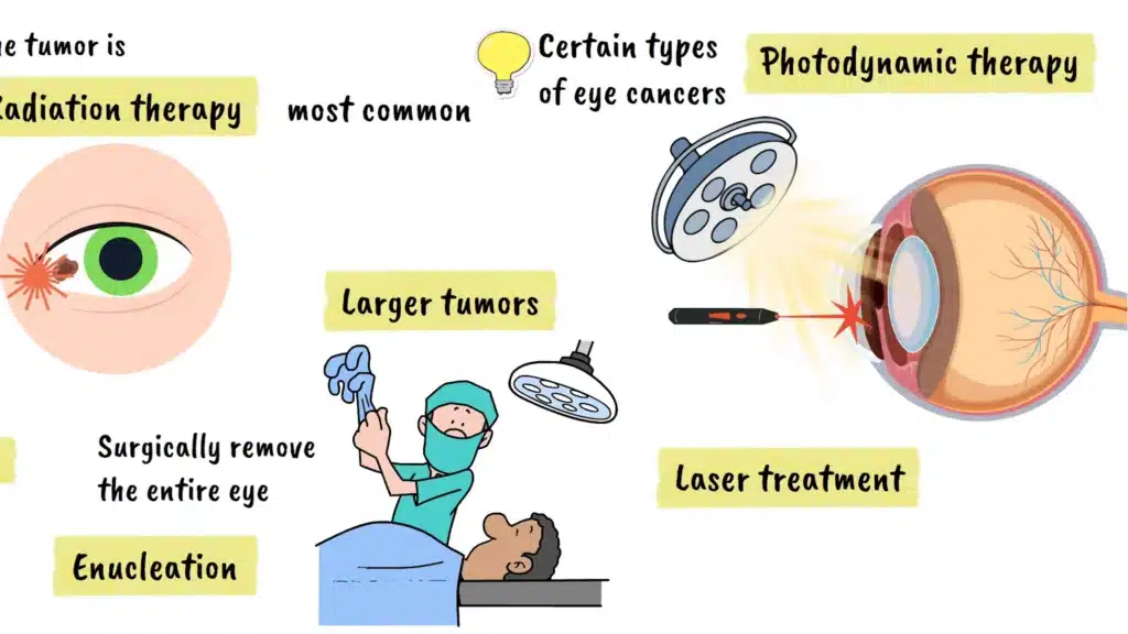 Ocular Melanoma photodynamic therapy