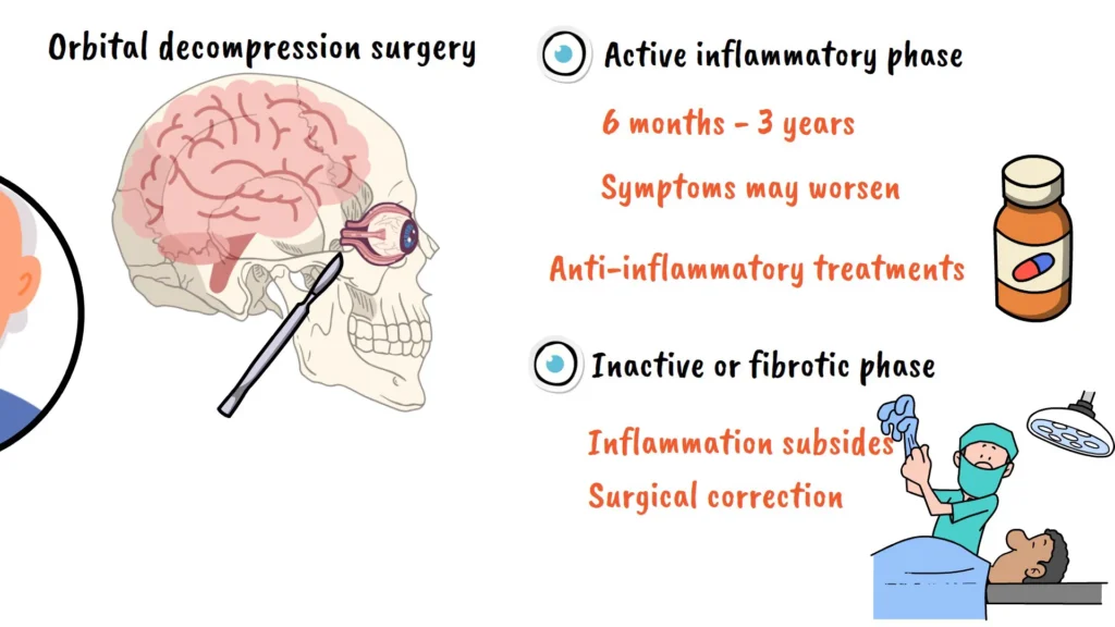 Orbital decompression surgery