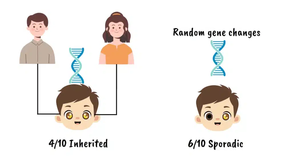 Retinoblastoma inherited vs sporadic