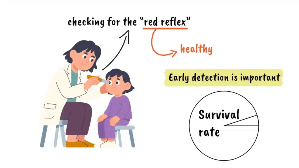 Retinoblastoma survival rate