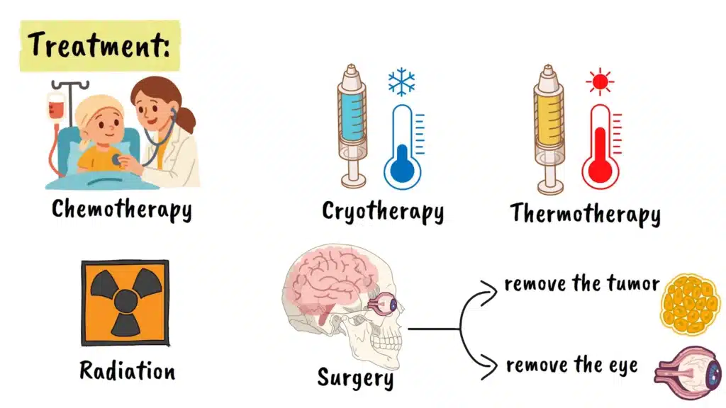 Retinoblastoma treatment