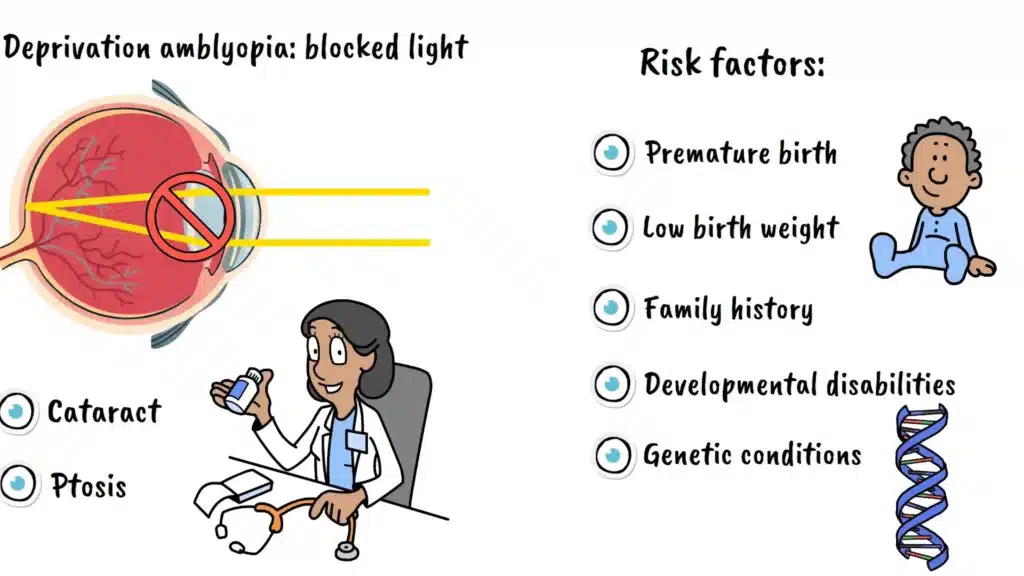 Risk factors of Amblyopia