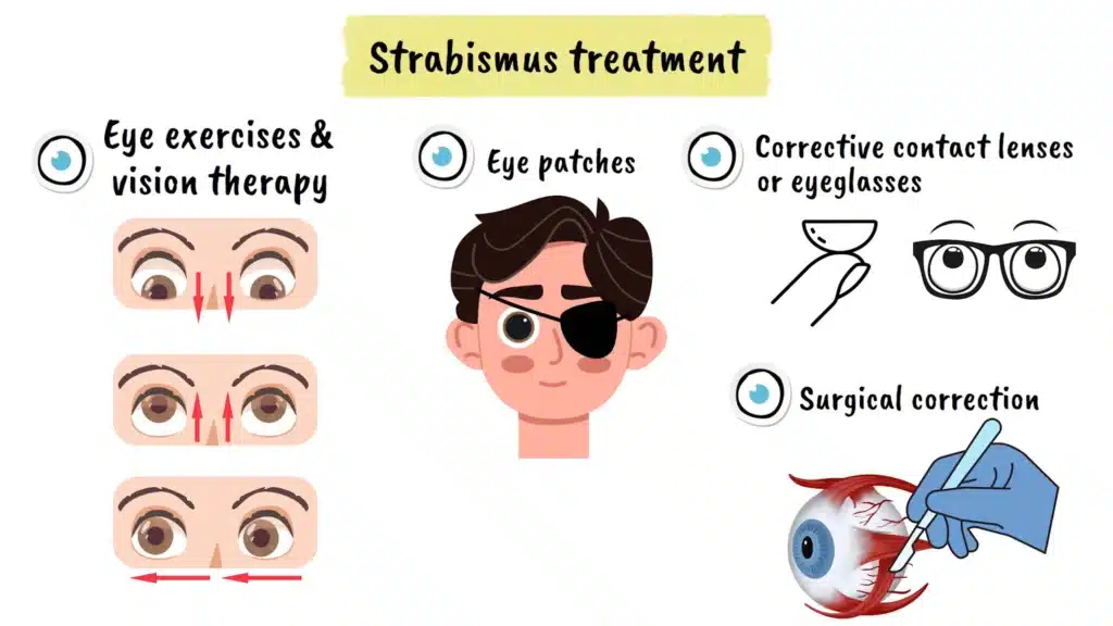 Strabismus treatment