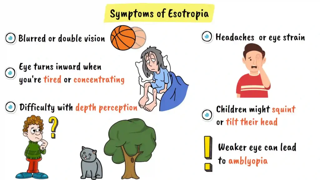 Symptoms of Esotropia