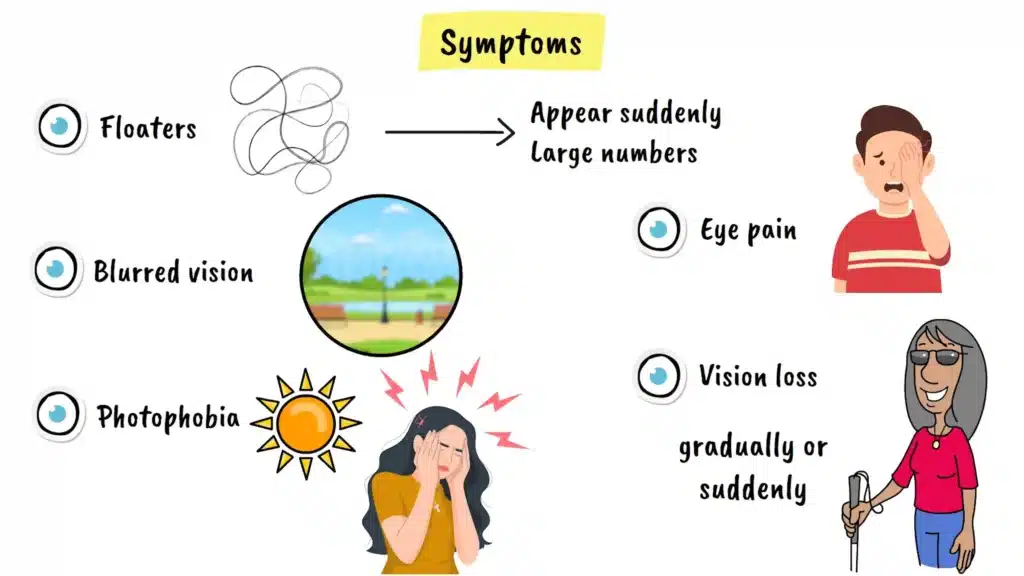 Symptoms of Ocular Syphilis