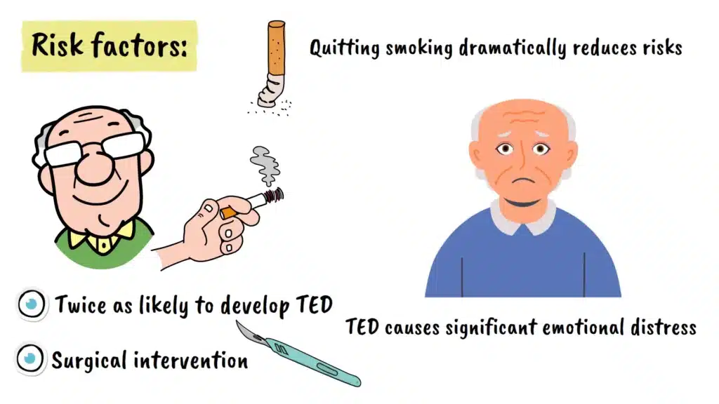 Thyroid Eye Disease risk factors