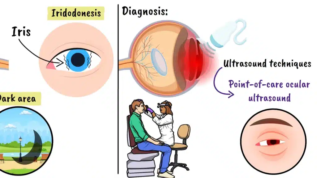 Traumatic Lens Dislocation diagnosis