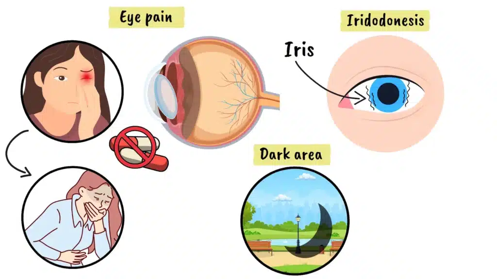 Traumatic Lens Dislocation eye pain and iridodonesis