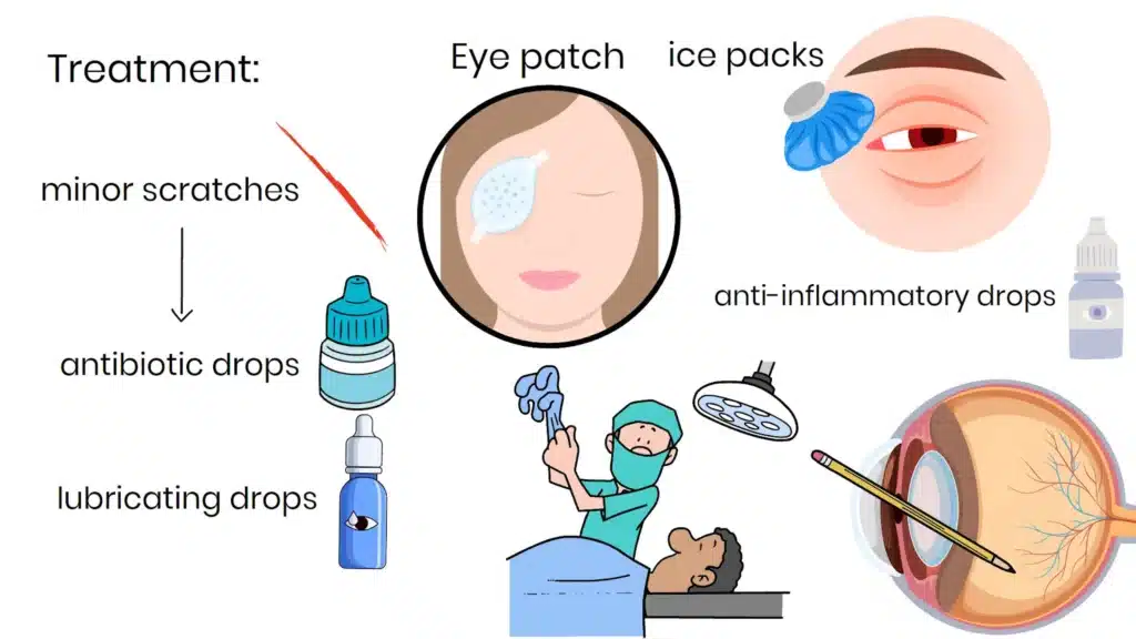 Treatment Options for Eye Trauma