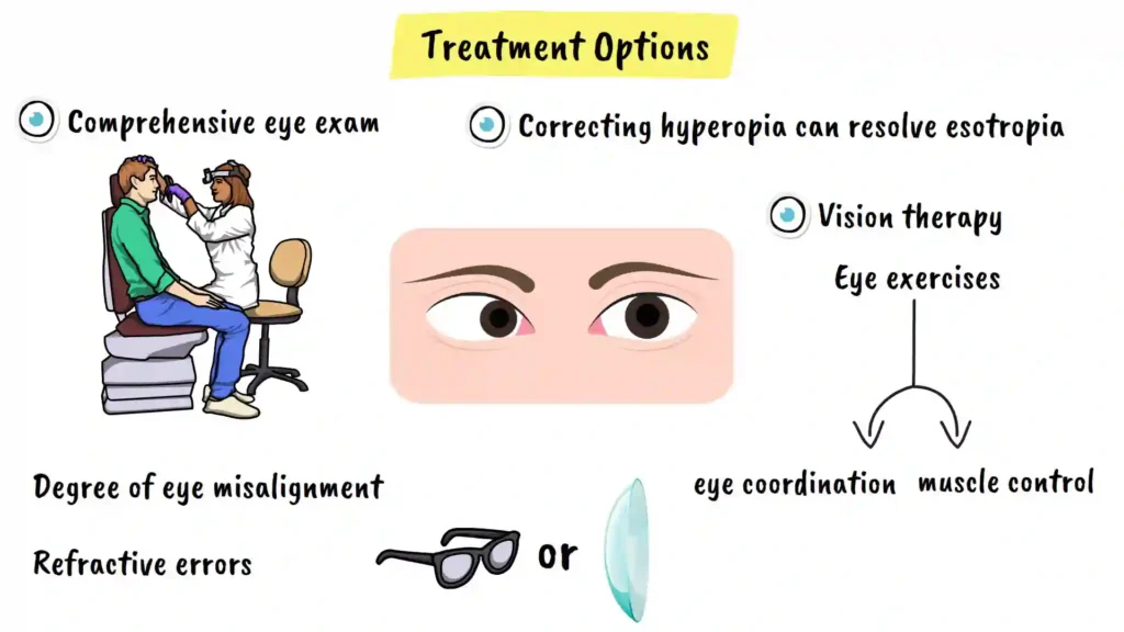 Treatment for Esotropia vision therapy